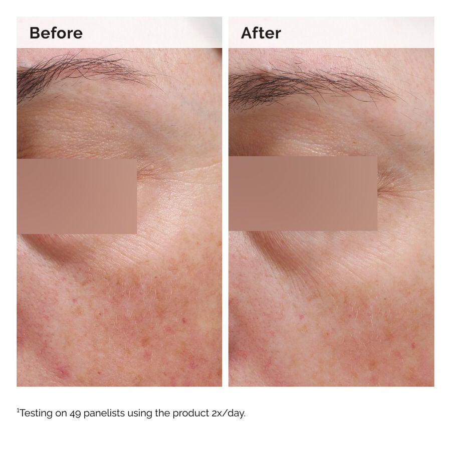 niacinamide-5-face-and-body-emulsion-a6 2024-08-23-ORD-Nia-5pct-Face-Body-B-A-Elasticity-Global-02-1x1.jpg
