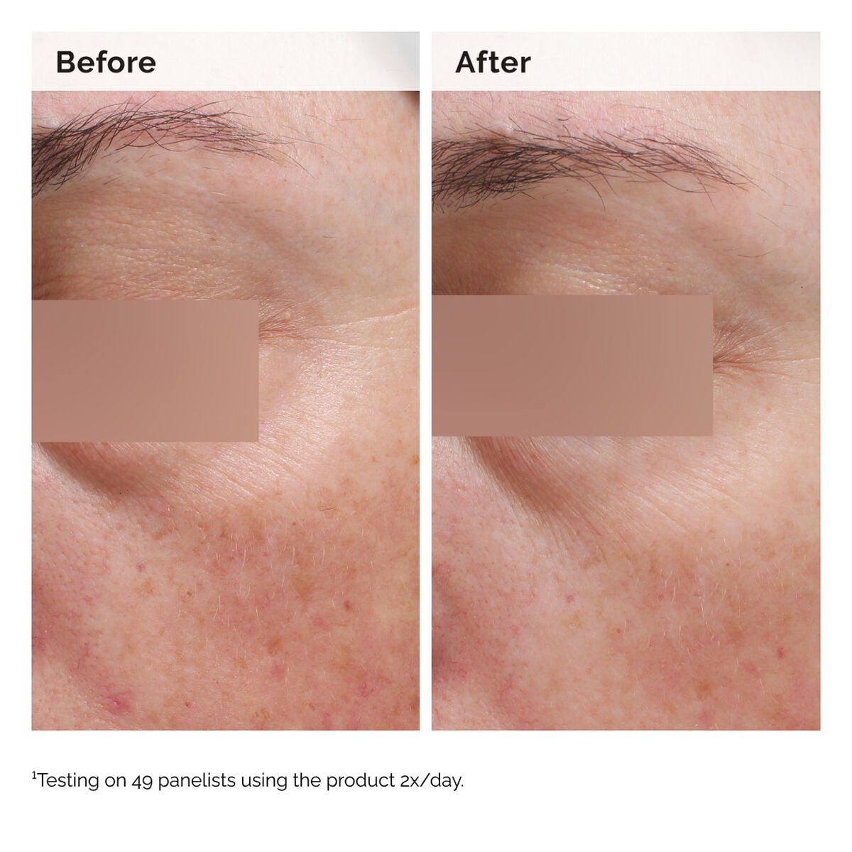 niacinamide-5-face-and-body-emulsion-a6 2024-08-23-ORD-Nia-5pct-Face-Body-B-A-Elasticity-Global-02-1x1.jpg