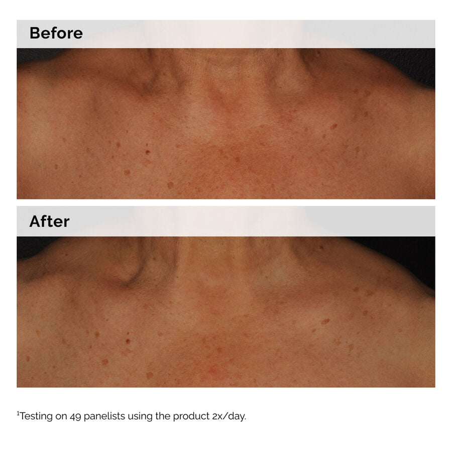 niacinamide-5-face-and-body-emulsion-a6 2024-08-23-ORD-Nia-5pct-Face-Body-B-A-Global-02-1x1.jpg