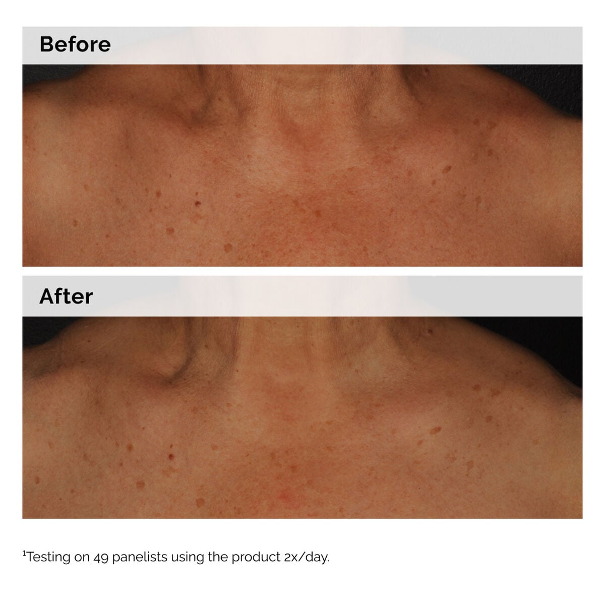 niacinamide-5-face-and-body-emulsion-a6 2024-08-23-ORD-Nia-5pct-Face-Body-B-A-Global-02-1x1.jpg