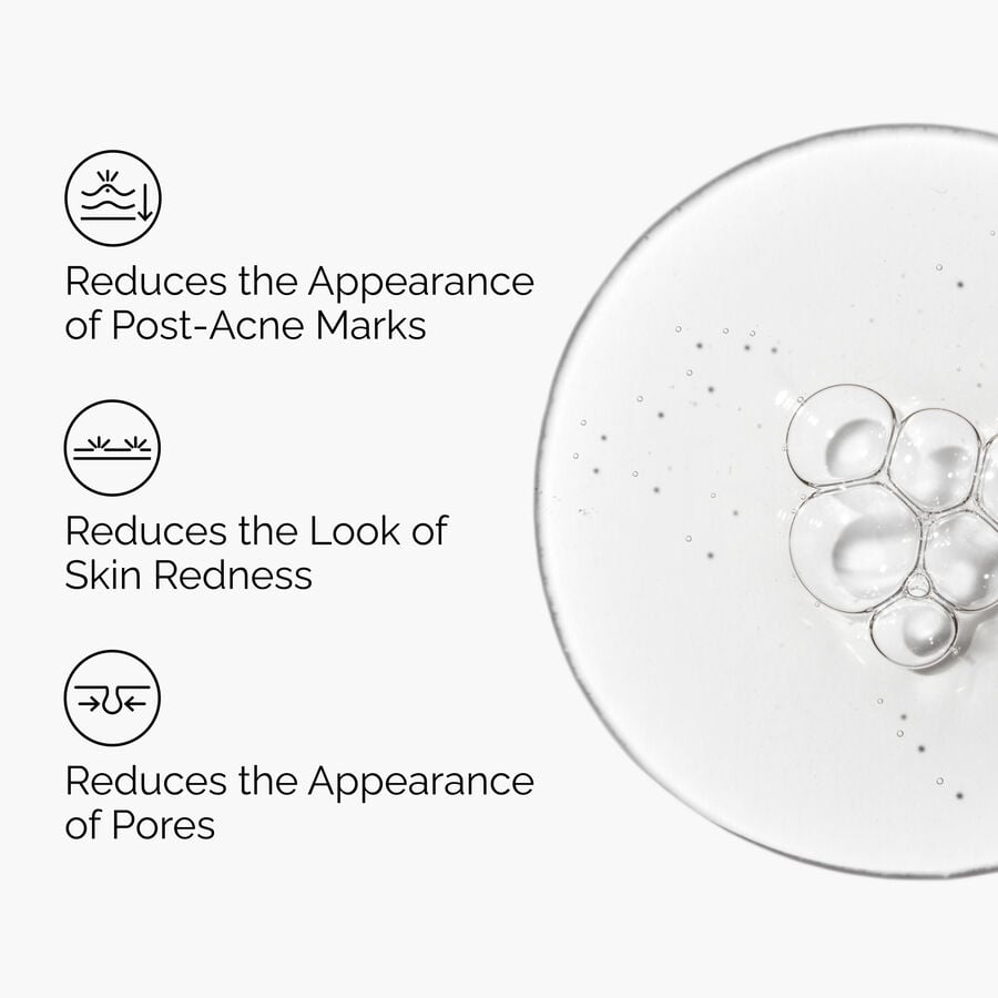 aloe-2-nag-2-solution-p5 FY25-D41247-ORD-Web-PDP-Aloe-Nag-1x1-EN-3a.jpg