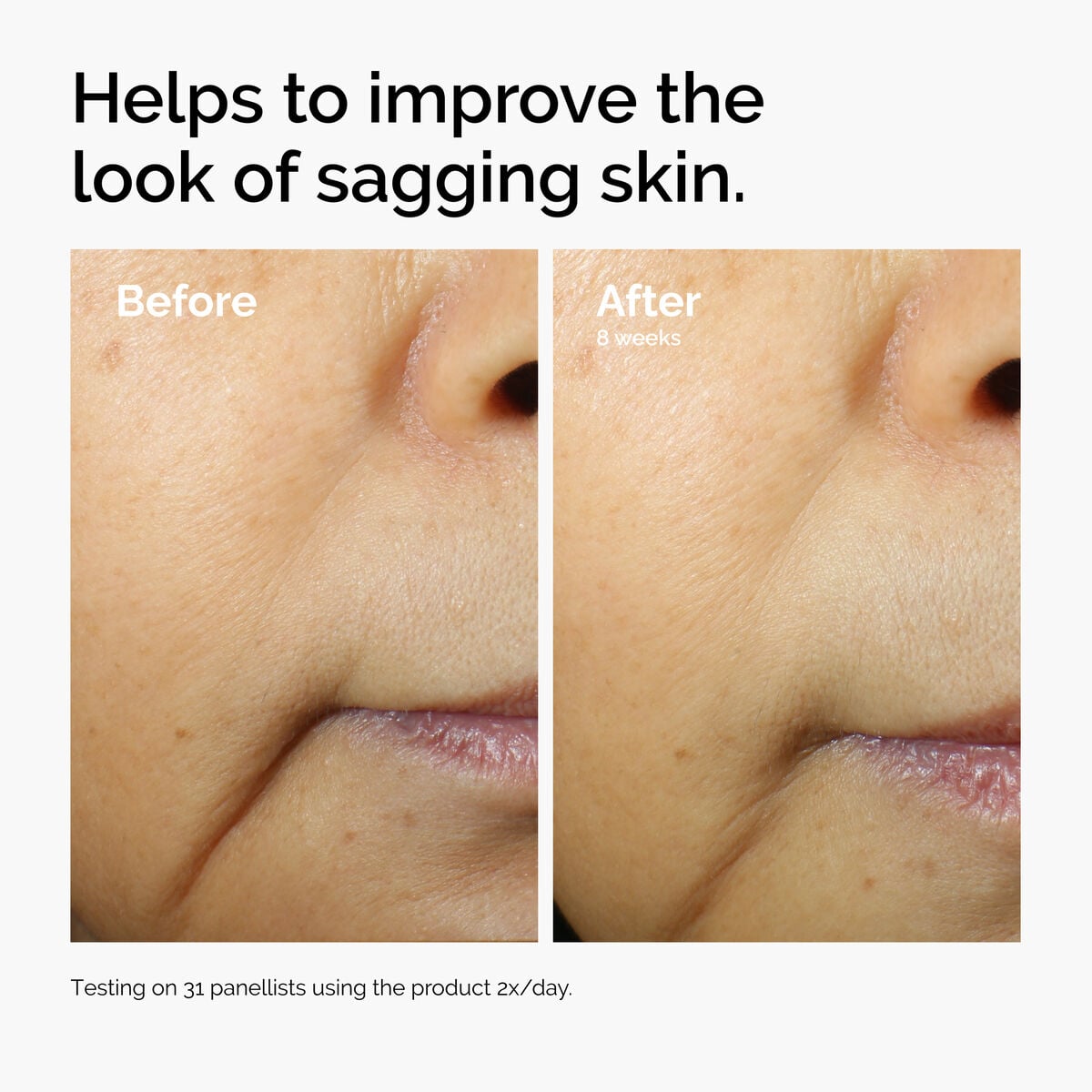 caffeine-3-escin-1-face-serum-n3 ord-caffeine-3pct-escin-1pct-face-serum-before-after-sagging.jpg