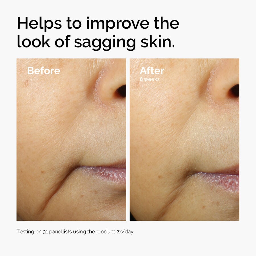 caffeine-3-escin-1-face-serum-n3 ord-caffeine-3pct-escin-1pct-face-serum-before-after-sagging.jpg