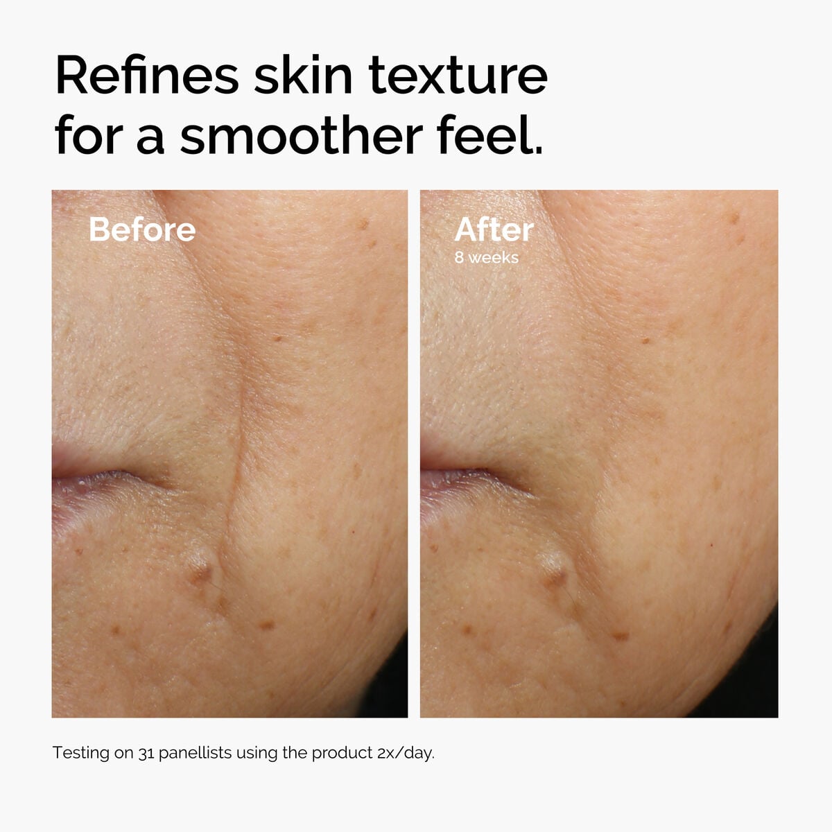 caffeine-3-escin-1-face-serum-n3 ord-caffeine-3pct-escin-1pct-face-serum-before-after-texture.jpg