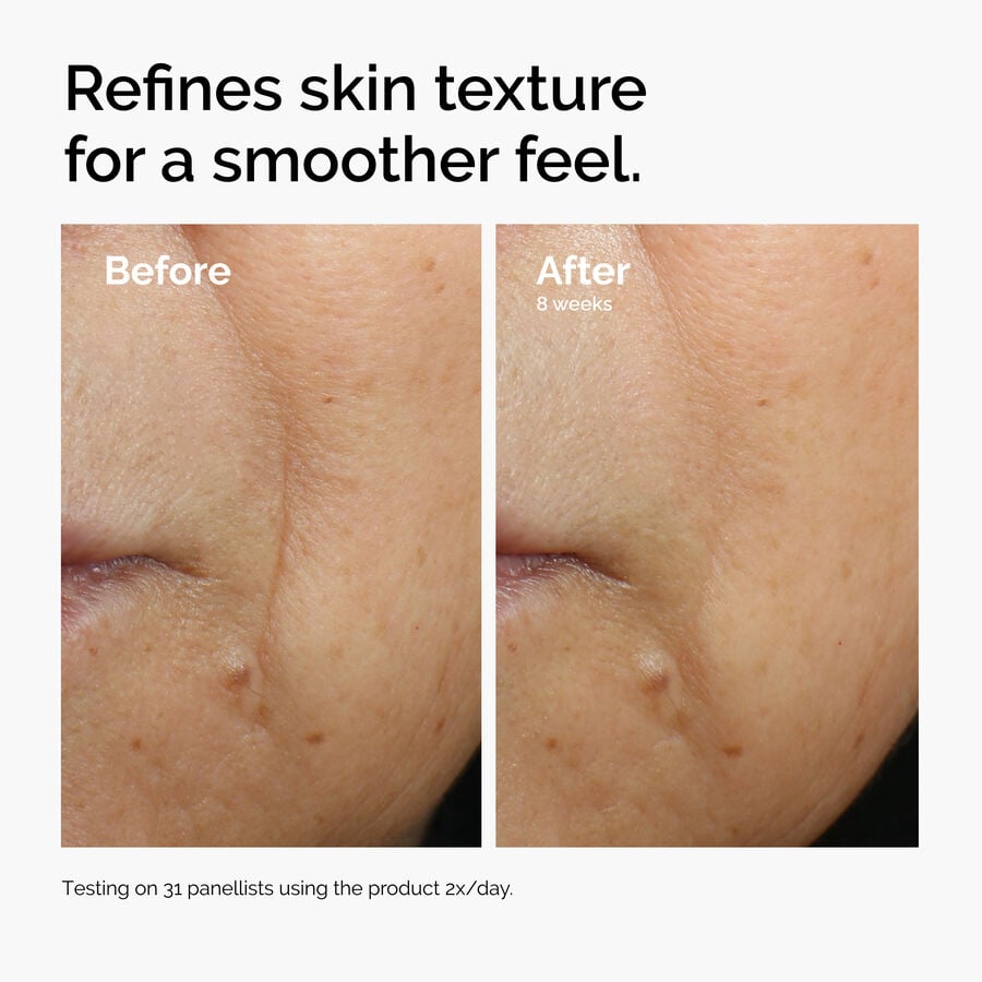 caffeine-3-escin-1-face-serum-n3 ord-caffeine-3pct-escin-1pct-face-serum-before-after-texture.jpg