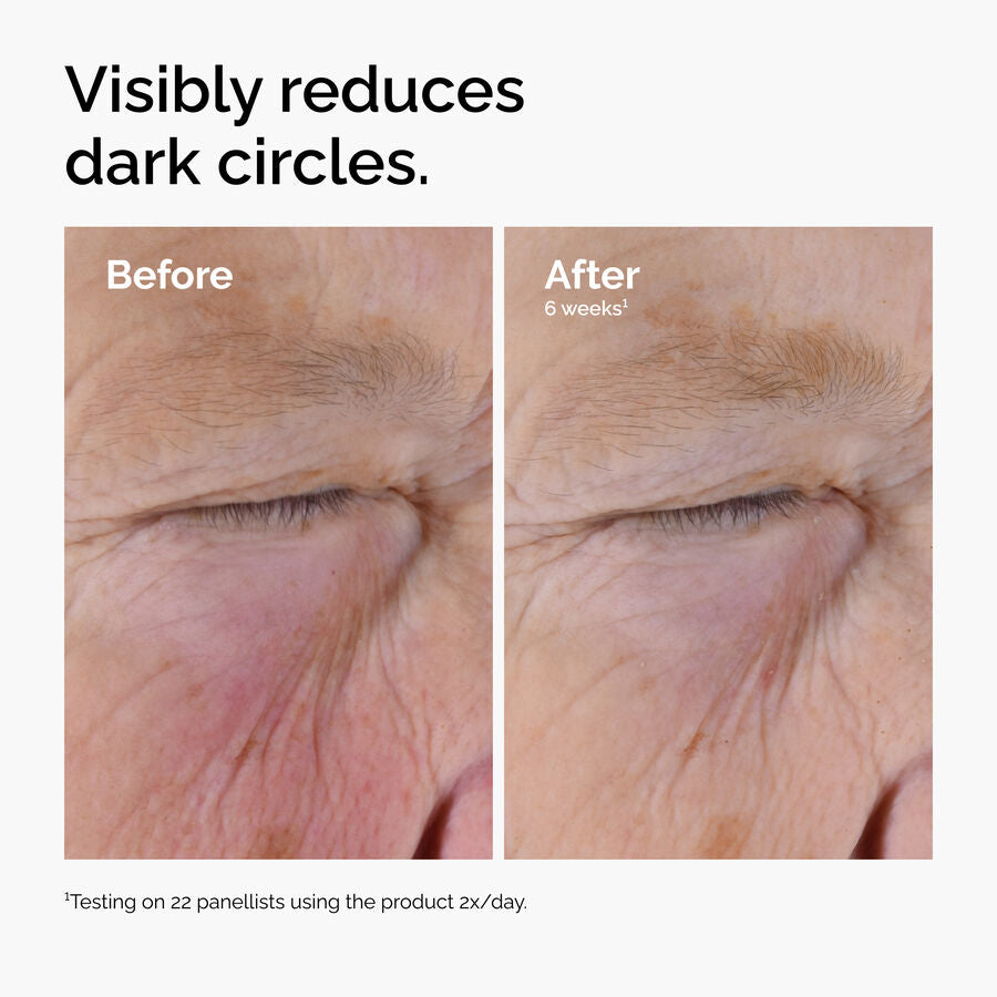 caffeine-solution-5-egcg-eye-serum-a3 ord-caffeine-solution-egcg-dark-circles-before-after.jpg