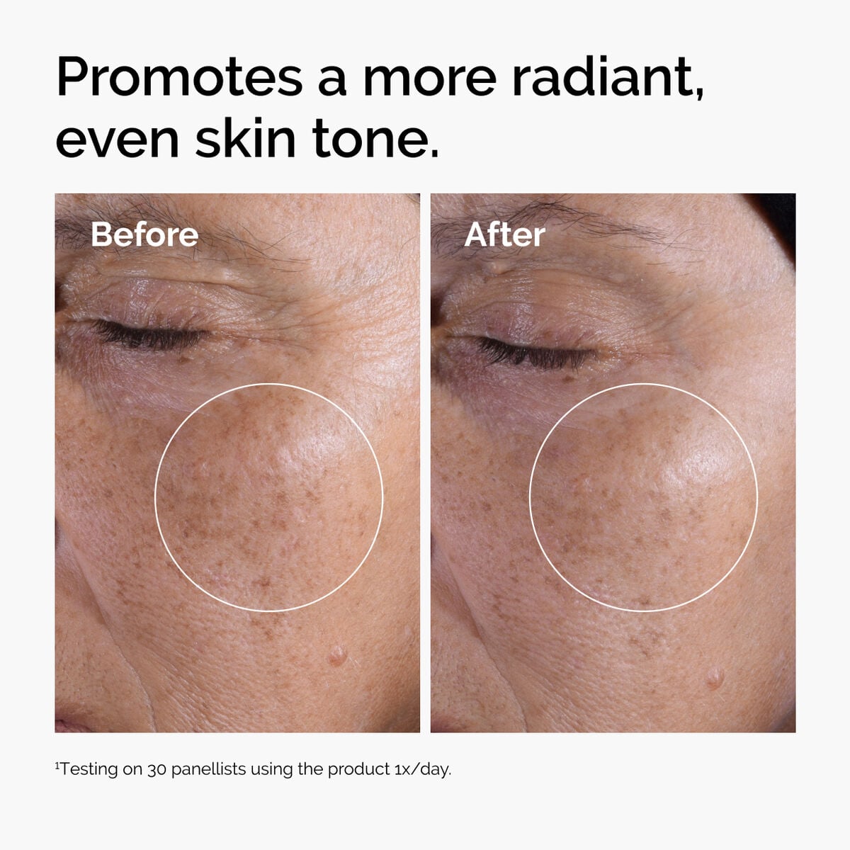 glycolic-acid-7-exfoliating-toner-l8 ord-glycolic-before-after-radiance.jpg