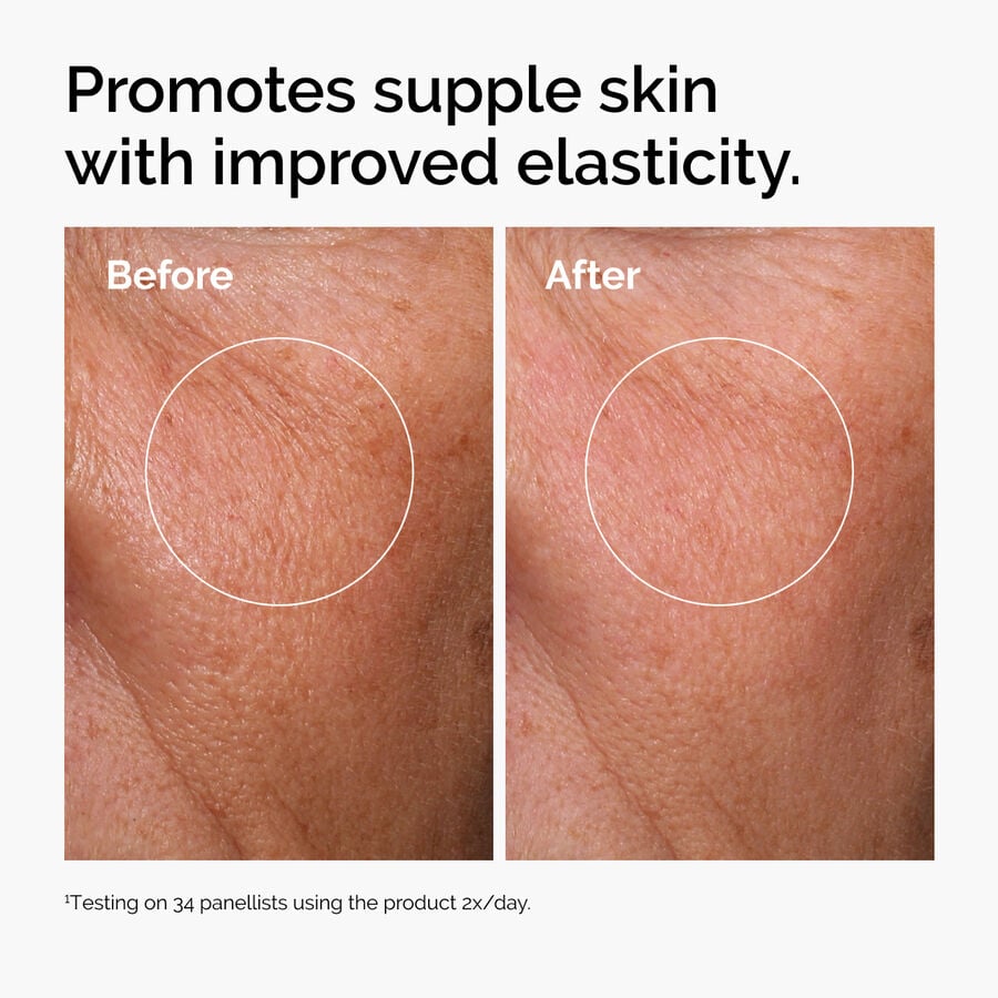 hyaluronic-acid-2-b5-with-ceramides-k3 ord-hyaluronic-acid-2pct-b5-hydrating-serum-before-after-elasticity.jpg
