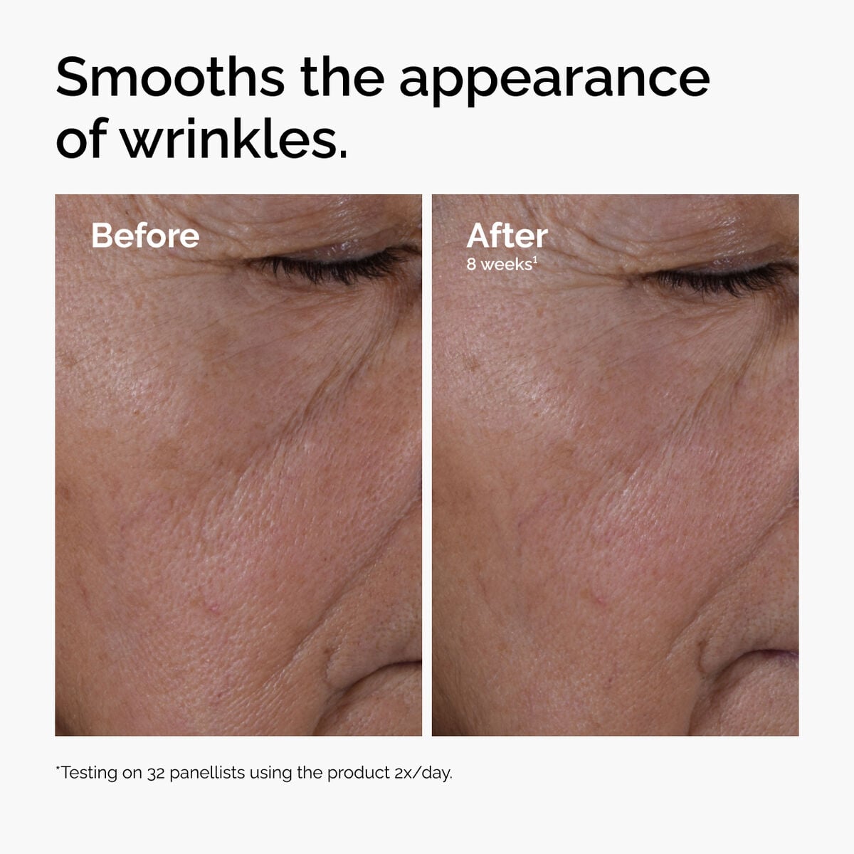 multi-peptide-ha-serum-f9 ord-multi-peptide-ha-serum-wrinkles-before-after.jpg