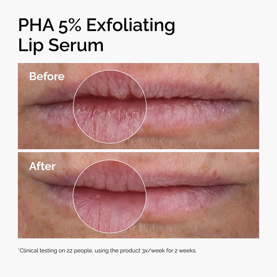 pha-5-exfoliating-lip-serum-u2 ord-pha-5pct-lip-exfoliating-serum-before-after.jpg
