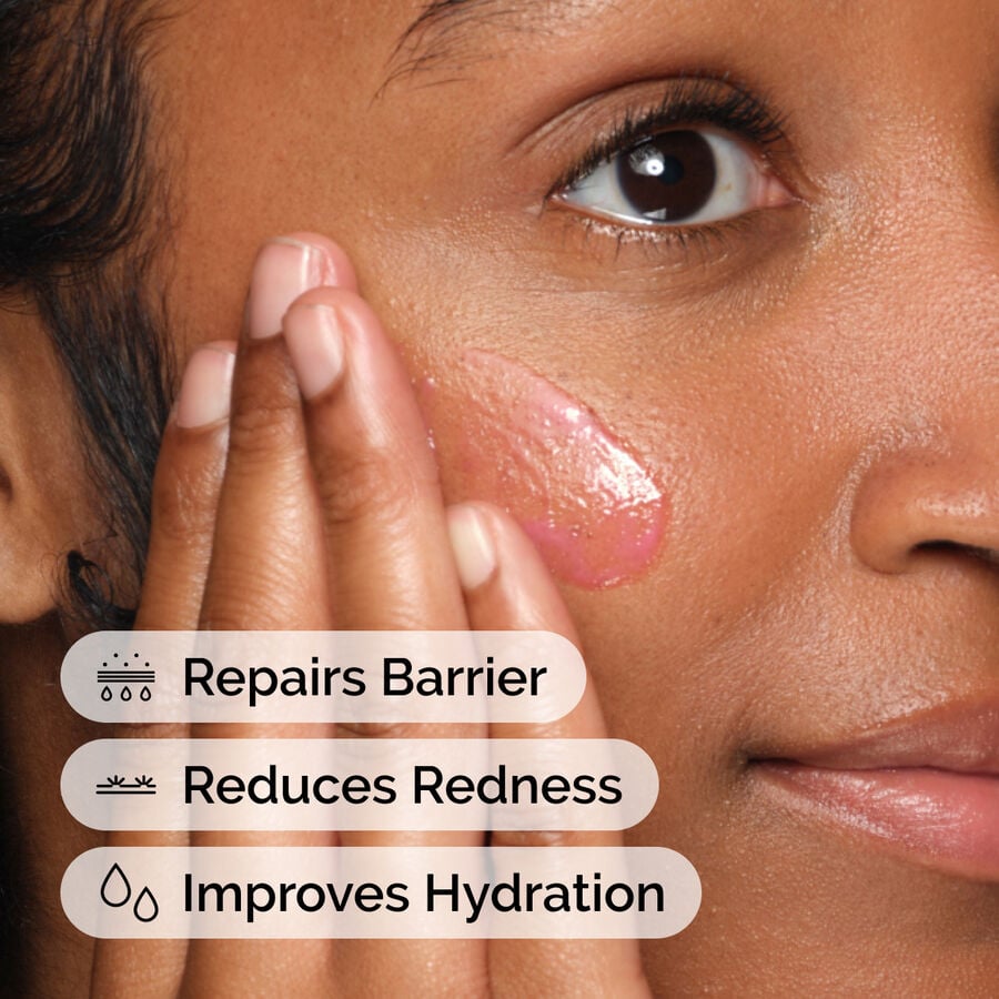 soothing-and-barrier-support-serum-a3 ord-soothing-barrier-support-serum-model-application-with-benefits.jpg